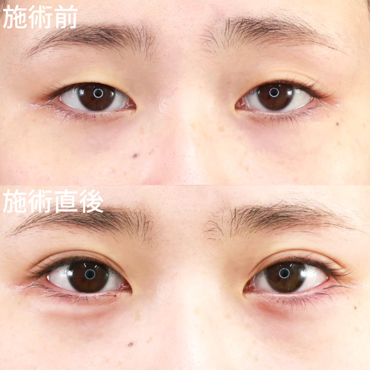 【クイックコスメリング】施術直後から超絶映える目元に！