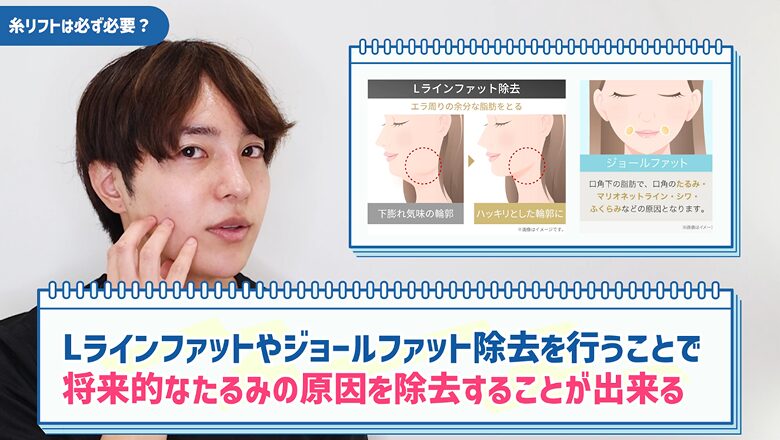 Lライン・ジョールファット除去で将来のたるみを予防できる