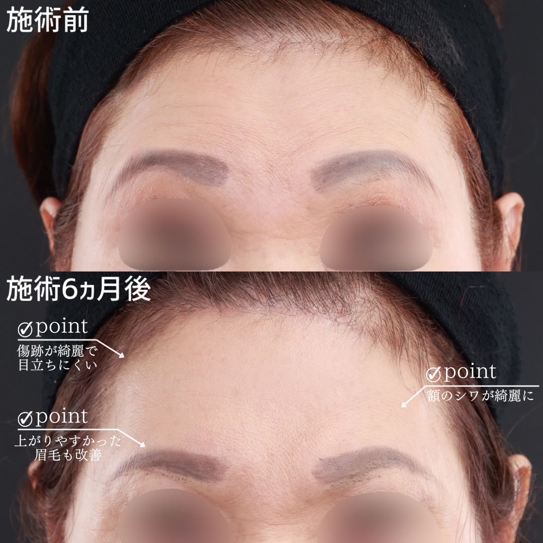 の症例写真 施術前後 