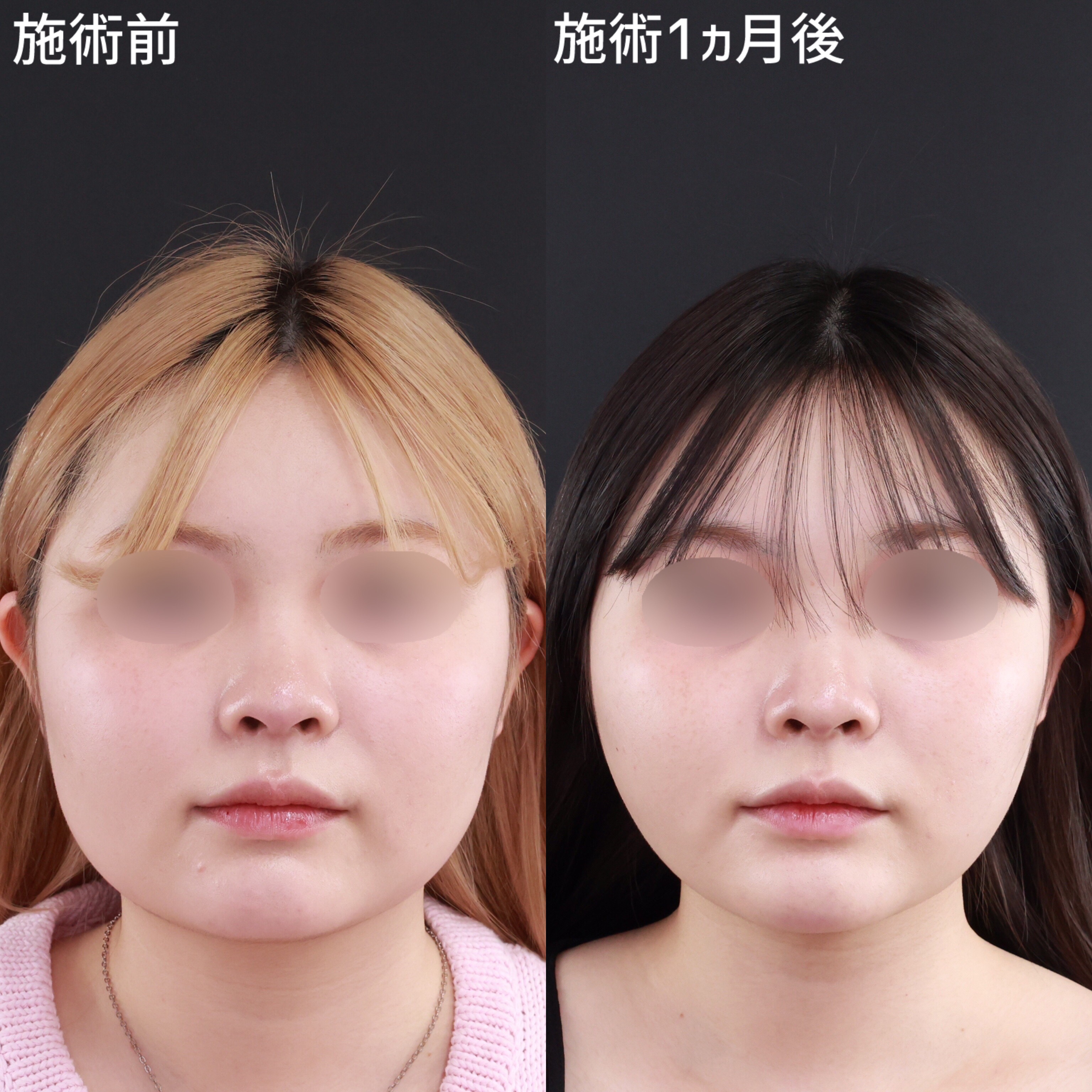 【パーフェクトフェイスライン】顔の余白をなくして自分史上最高な私に