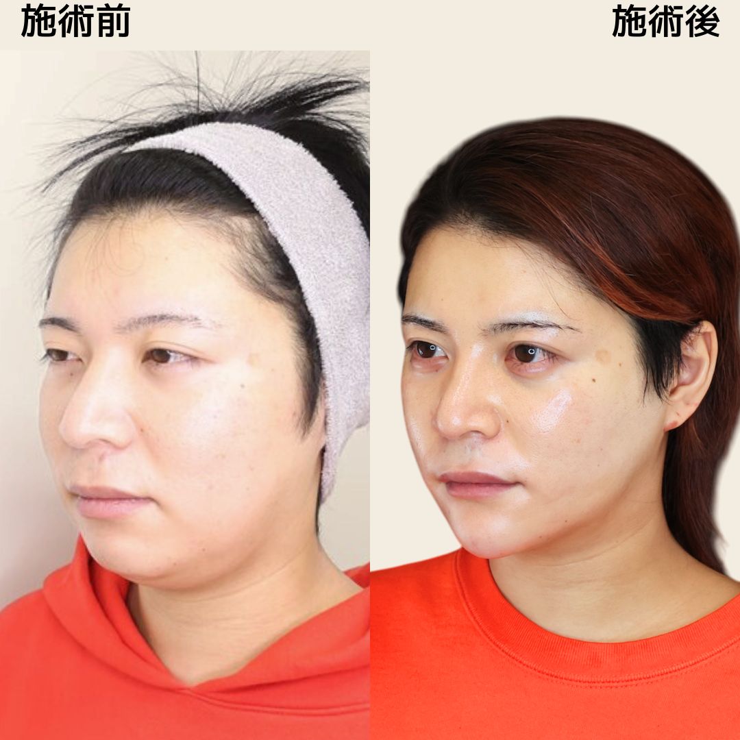 《メンズ美容》二度見してしまう程のイケメンに大変身