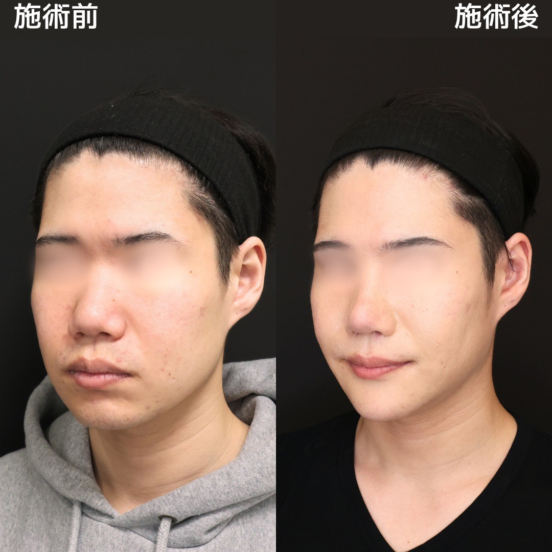 《メンズ美容》美容を教えてもらって人生変わりました