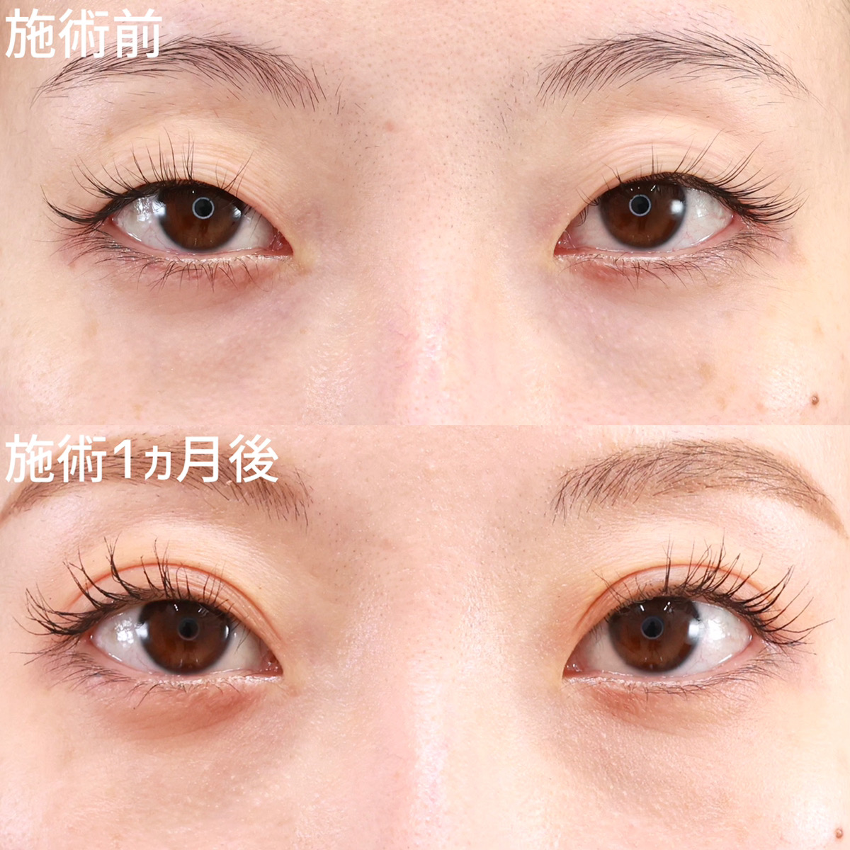 【クイックコスメリング】目元に馴染む美しい平行二重に！