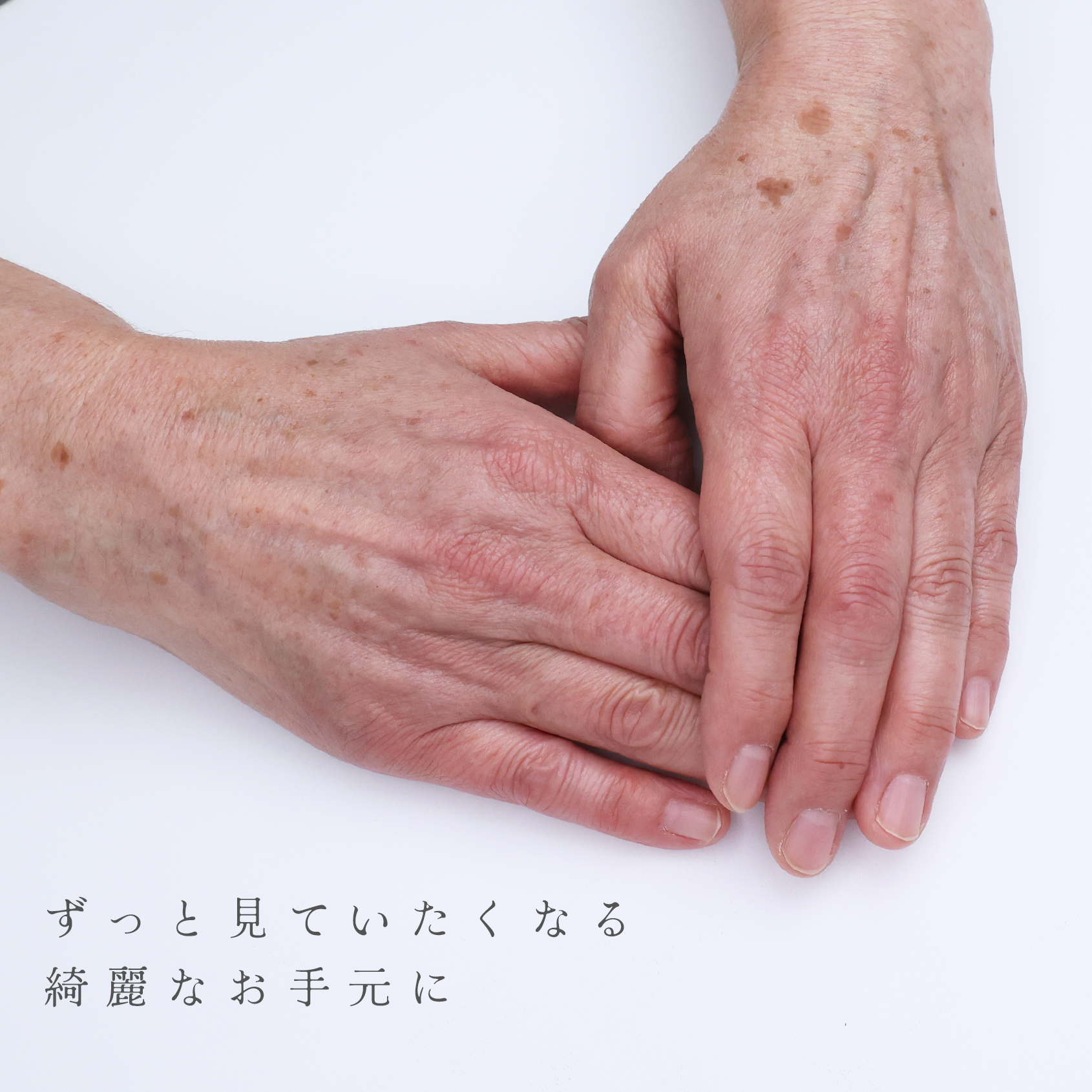 ハンドベイン（手のアンチエイジング・血管治療）の症例写真 施術前後 