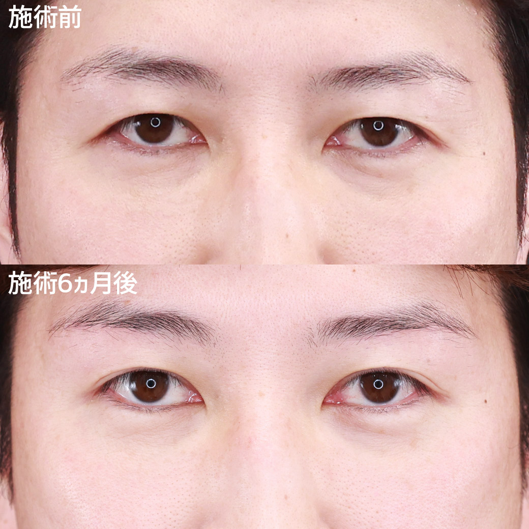 目元 
