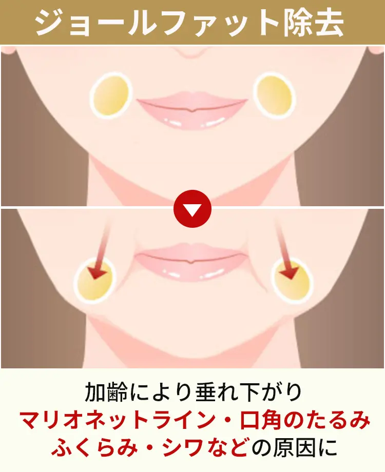 ジョールファットとは
