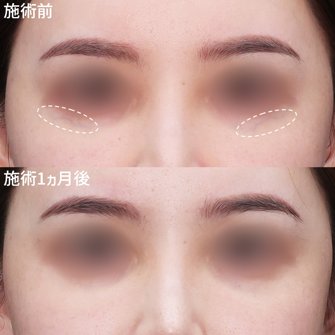 美容外科：その他の症例写真 施術前後 