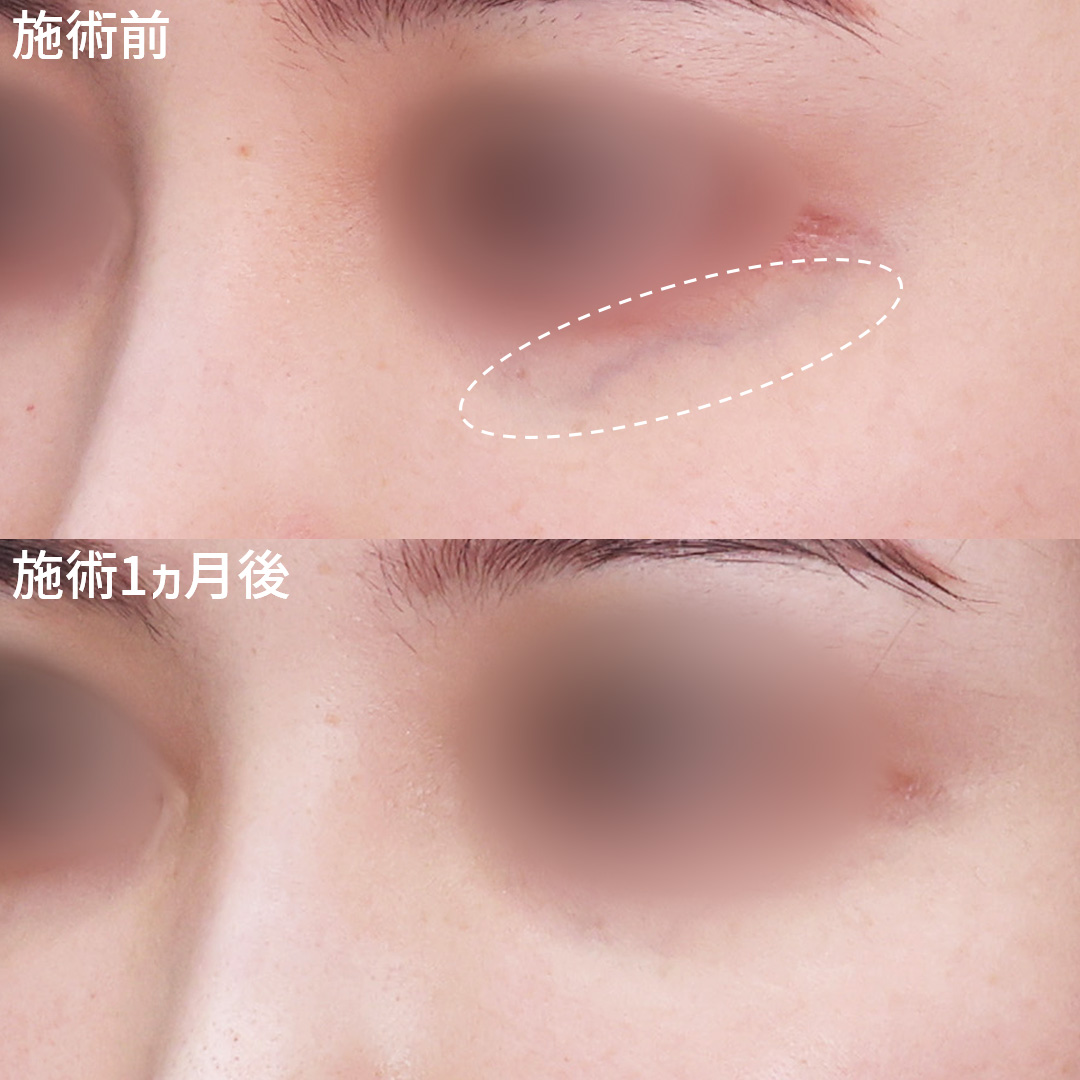 美容外科：その他の症例写真 施術前後 