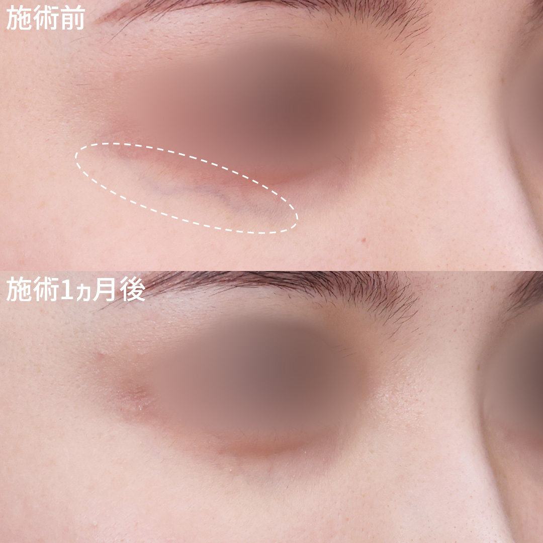 美容外科：その他の症例写真 施術前後 