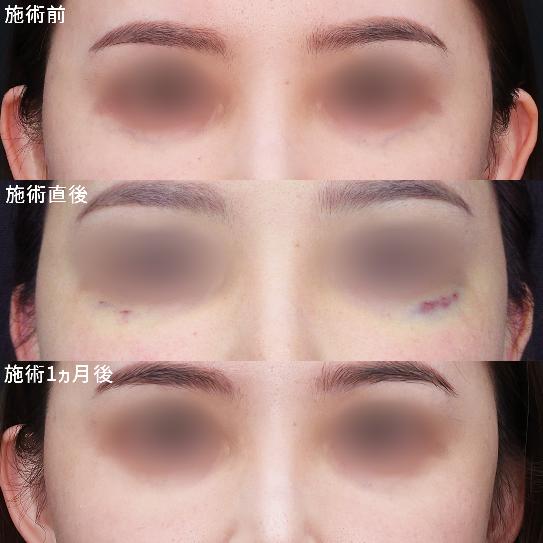 美容外科：その他の症例写真 施術前後 