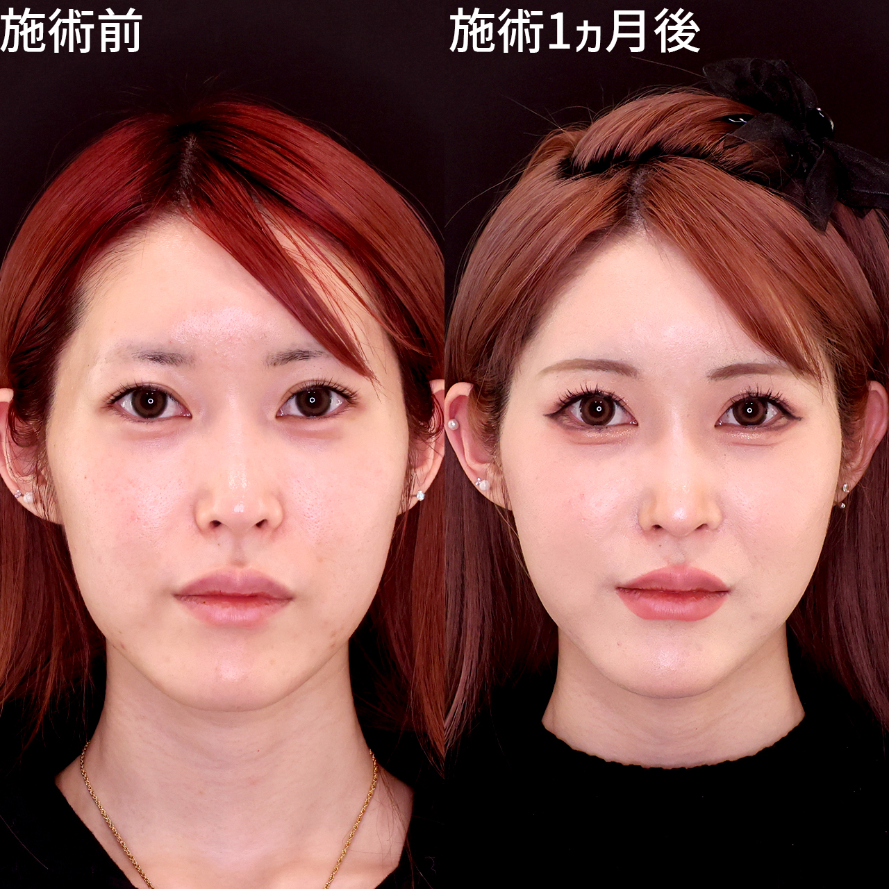 美人の絶対条件って知ってる？顔の余白を整え小顔美人に