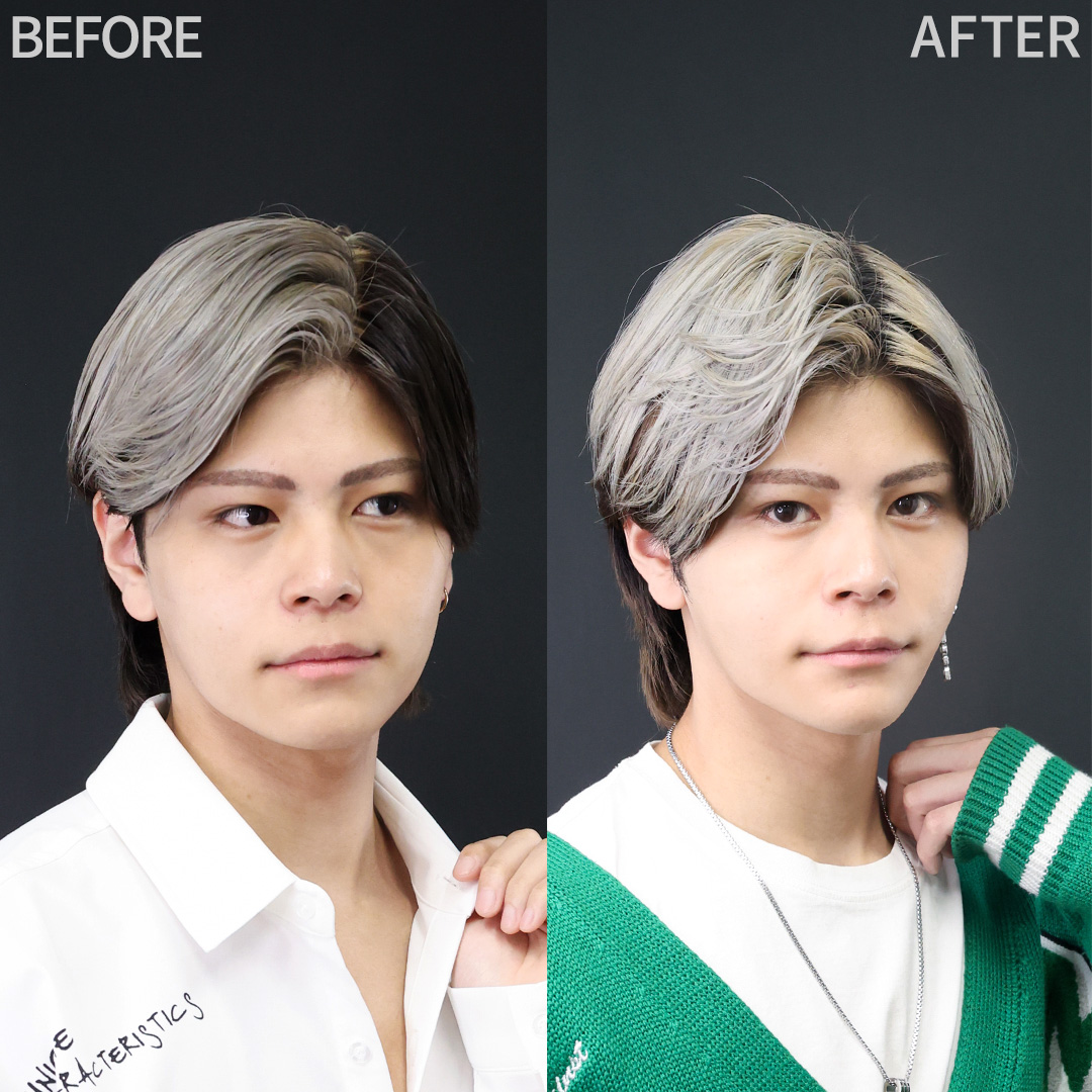 イケメンに拍車をかける小顔整形