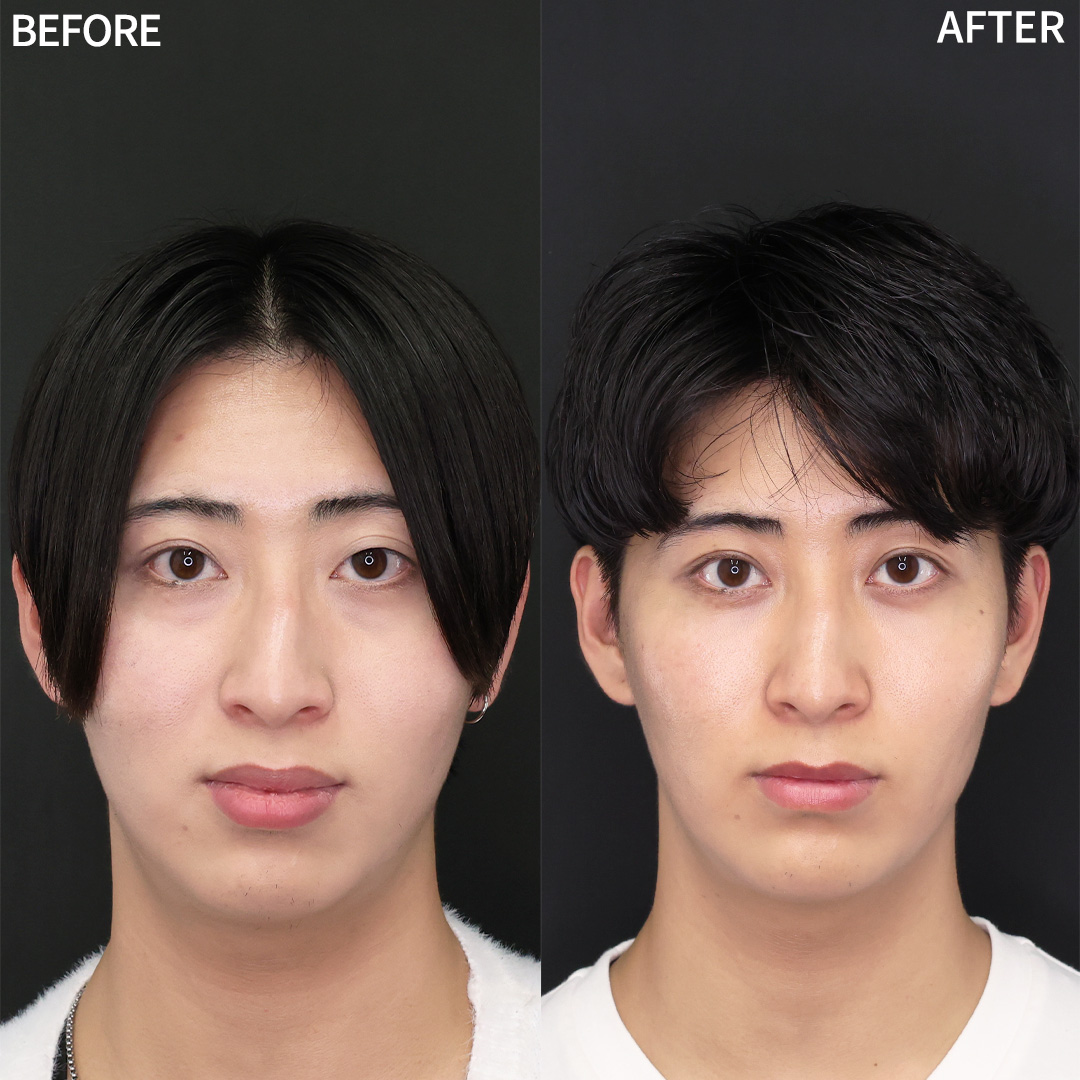 〈トータルプロデュース〉人生が変わるメンズ整形