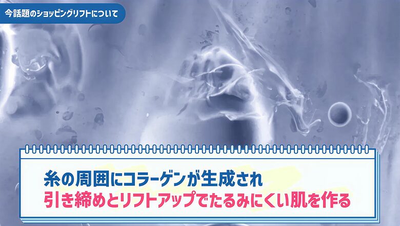 糸の周囲にコラーゲンが生成され引き締めとリフトアップでたるみにくい肌を作る