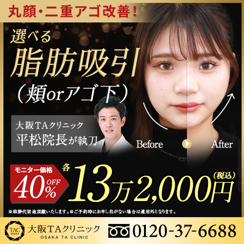 平松医師_選べる顔の脂肪吸引_モニター募集