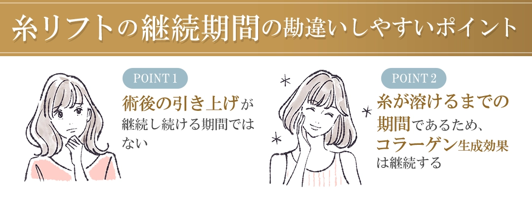 糸リフトの持続期間を説明するイラスト