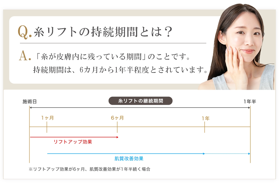糸リフトの持続期間と効果を示した図