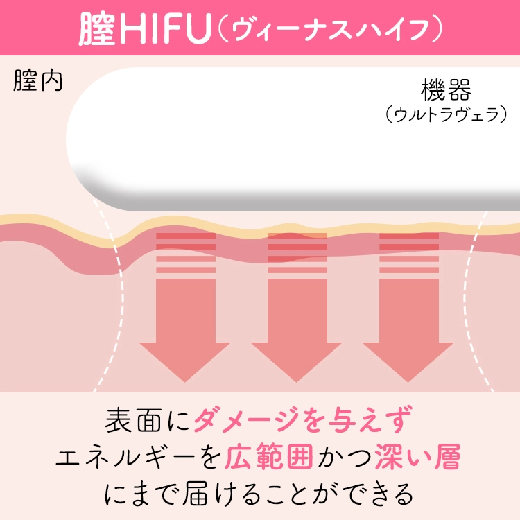 ヴィーナスハイフ