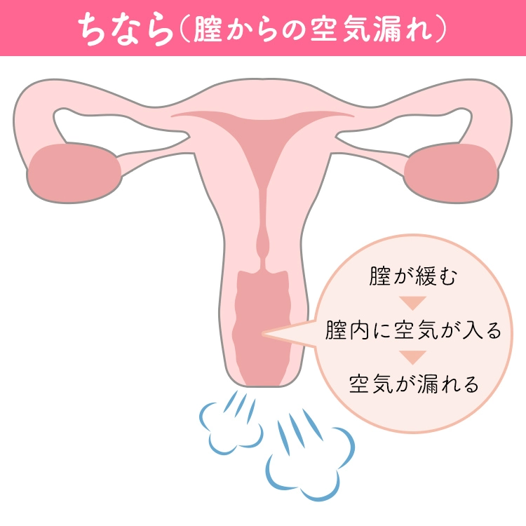 ちなら