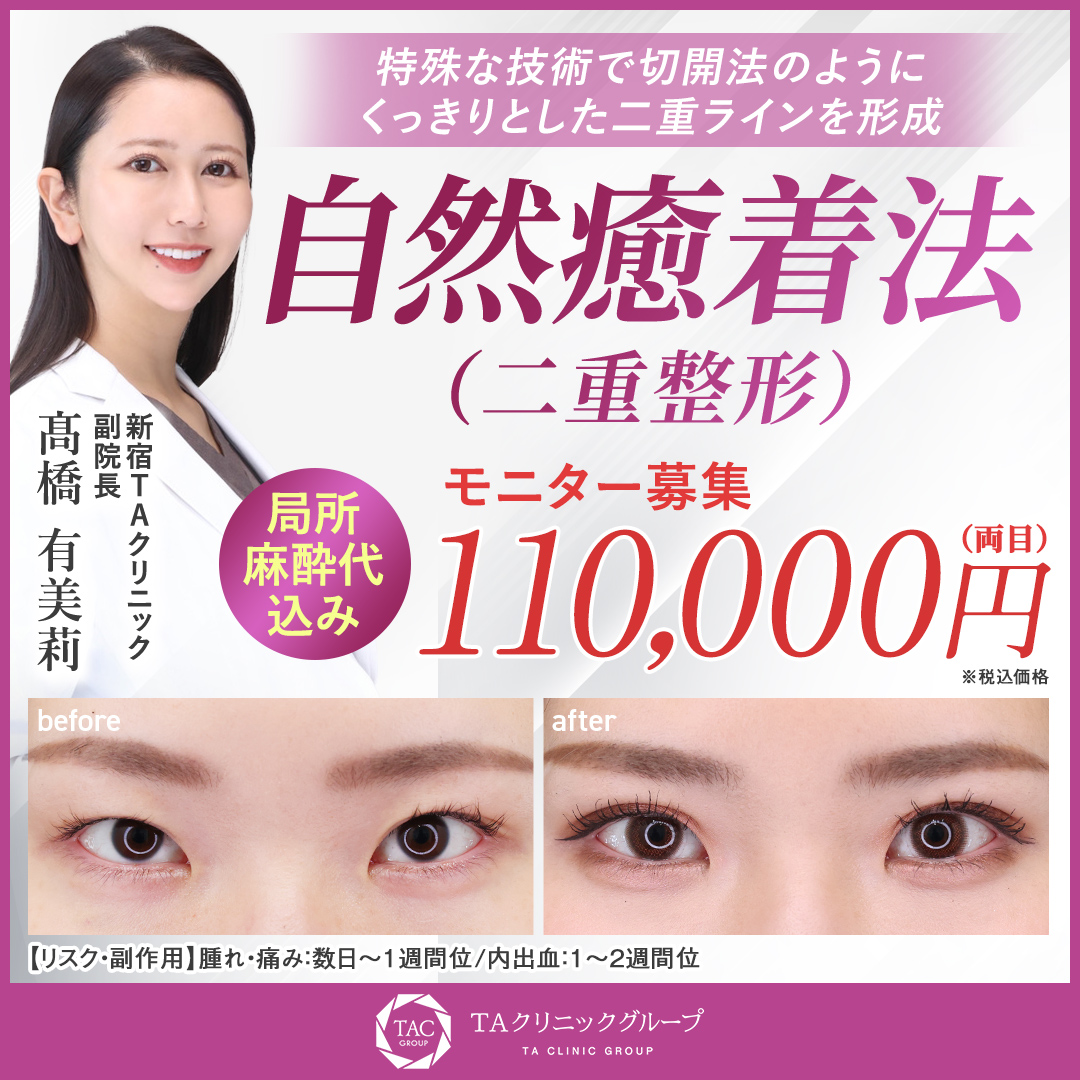 髙橋医師_自然癒着法_モニター募集