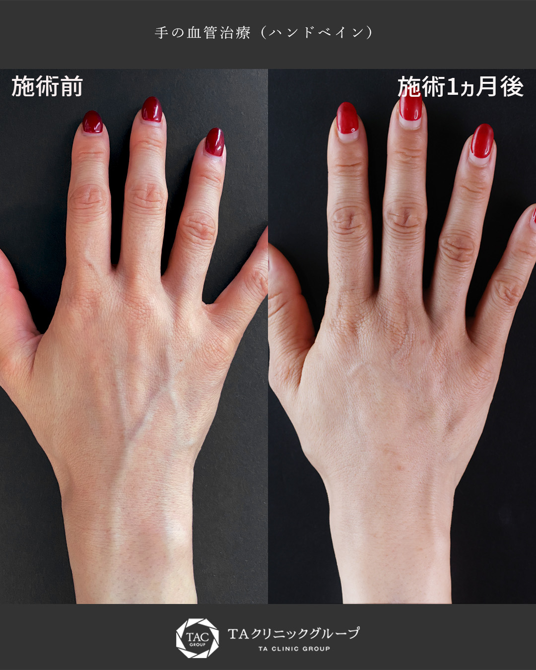 滑らかな美しいお手元に