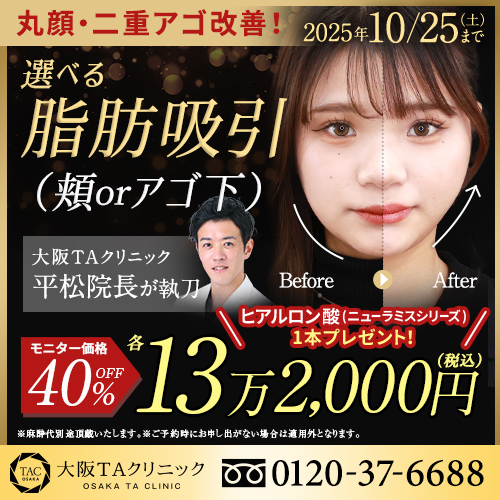 平松医師_選べる顔の脂肪吸引_モニター募集