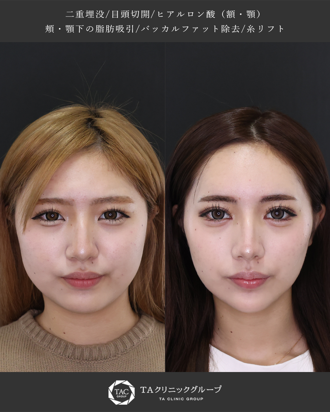 《目元×小顔》自分をアップデートする