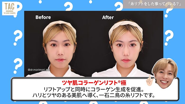 ツヤ肌コラーゲンリフト®極とは