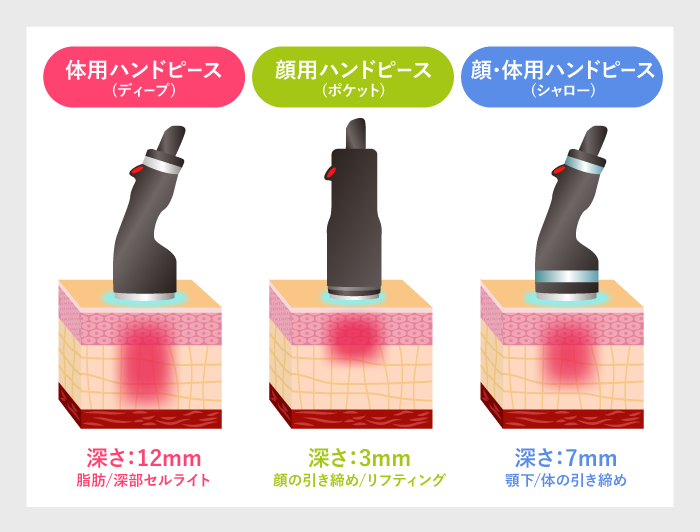 オンダプロのハンドピース