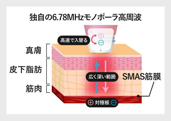 ボルニューマの仕組み