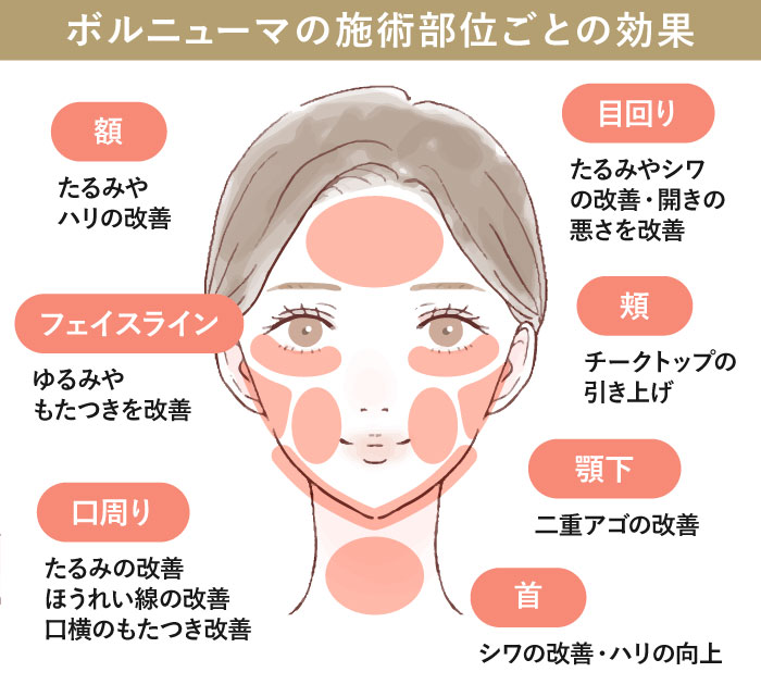 ボルニューマの期待できる効果