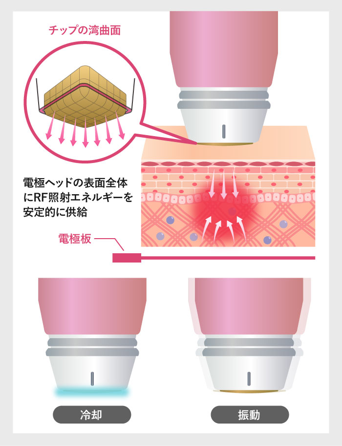 ボルニューマのメリット