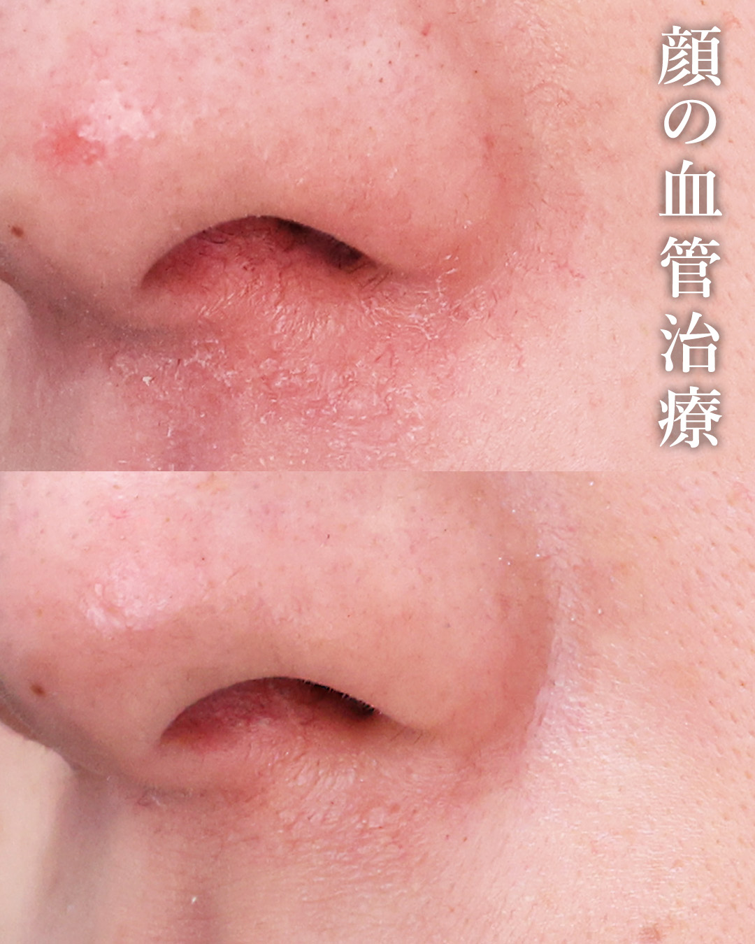 美容外科：その他の症例写真 施術前後 