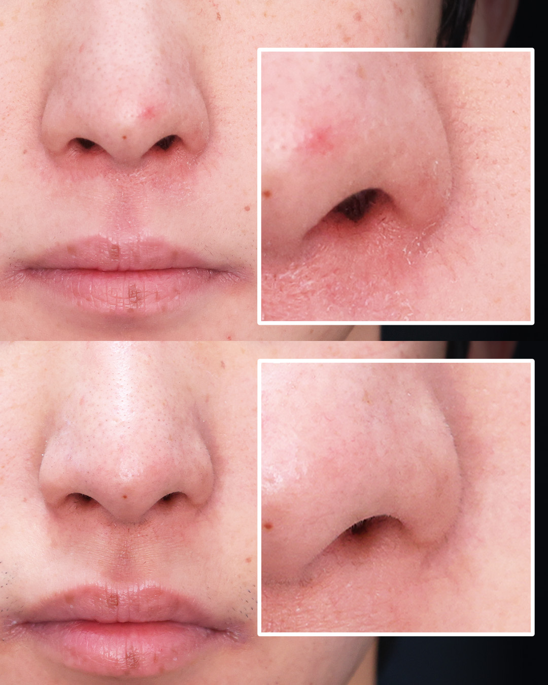 美容外科：その他の症例写真 施術前後 