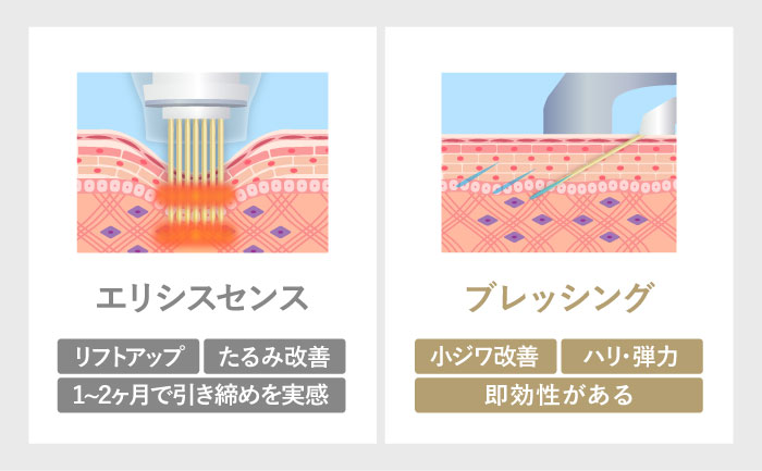 エリシスセンスとの違い