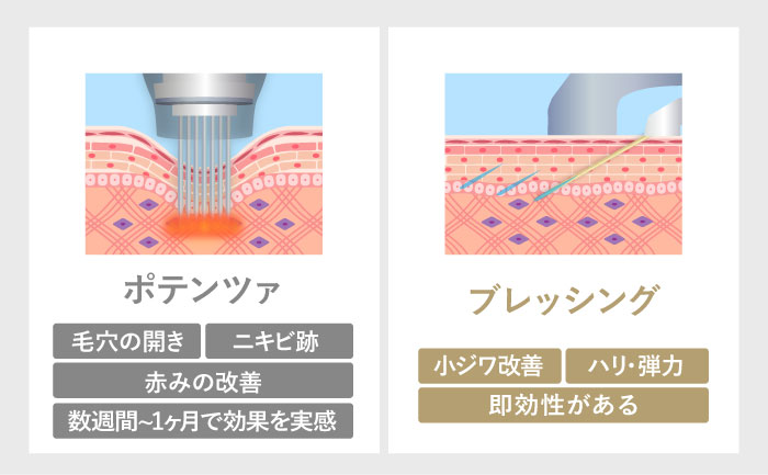 ポテンツァとの違い