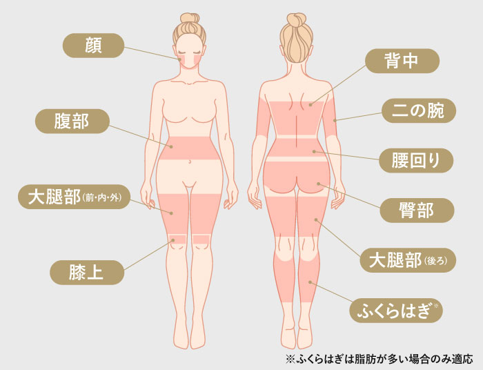 オンダリフト 施術部位