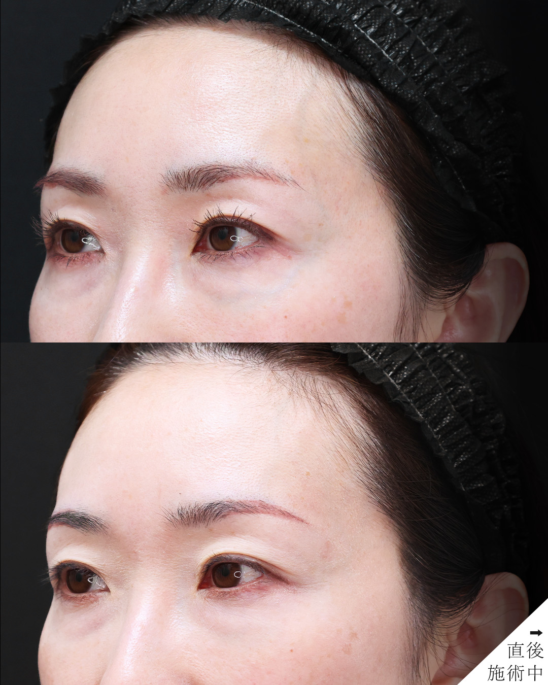 美容外科：その他の症例写真 施術前後 