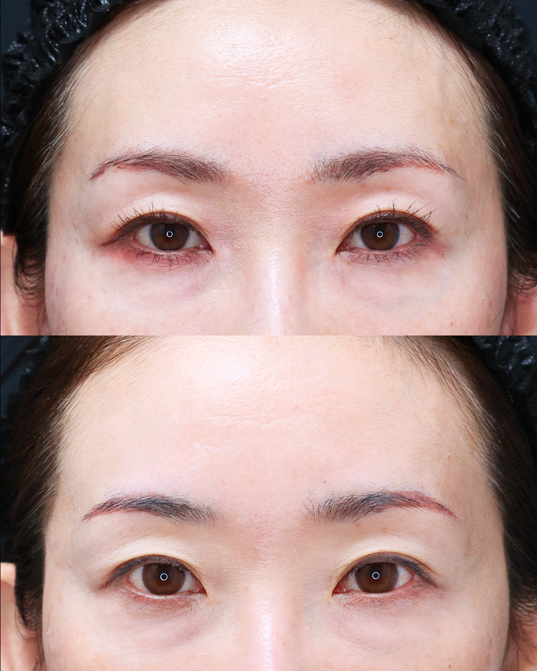 美容外科：その他の症例写真 施術前後 