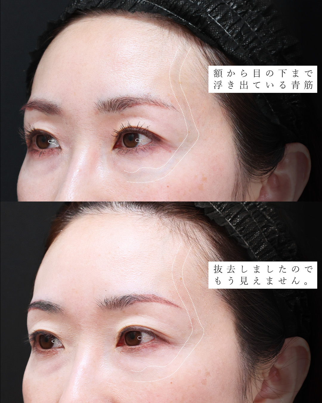 美容外科：その他の症例写真 施術前後 