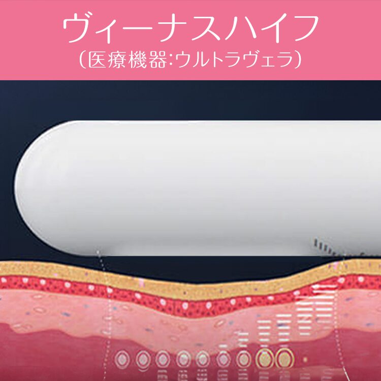 ヴィーナスハイフ（膣ハイフ）