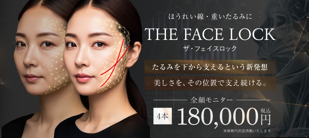 ザ・フェイスロック｜引き上げて“安定させる”独自設計の糸リフト