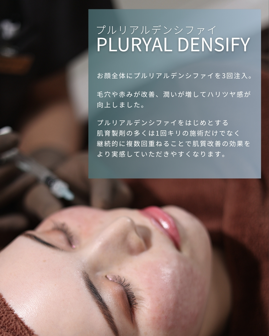 プルリアルデンシファイの症例写真 施術前後 
