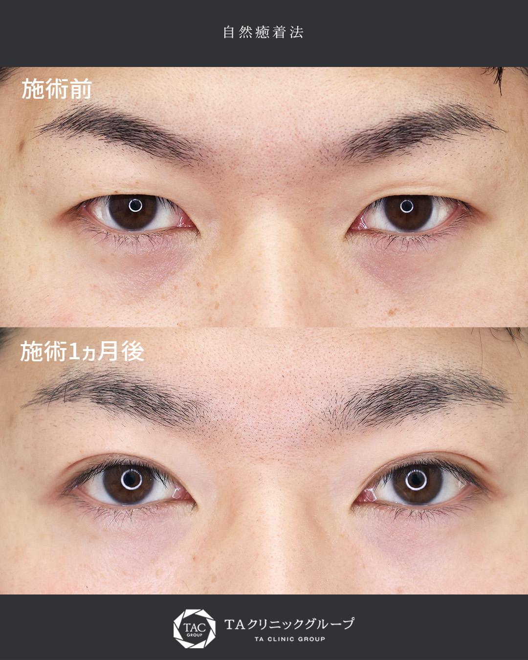 自然癒着法で印象UP！仕事も順調に◎│30代男性