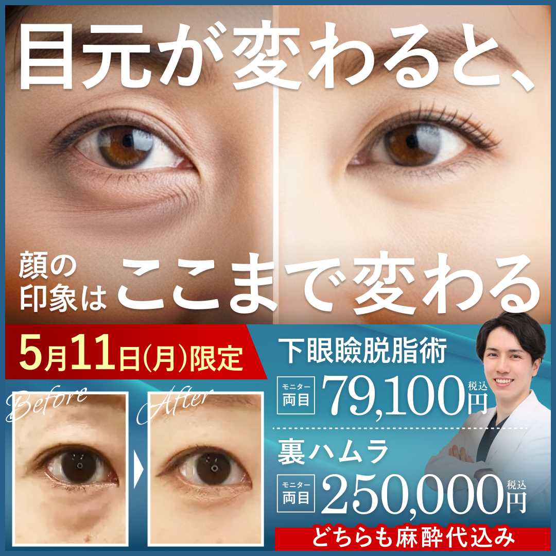 5/11限定_高崎院_クマとり_モニター募集