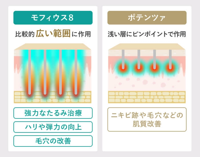 モフィウス8とポテンツァの違い（作用範囲と効果の違いを比較した図）
