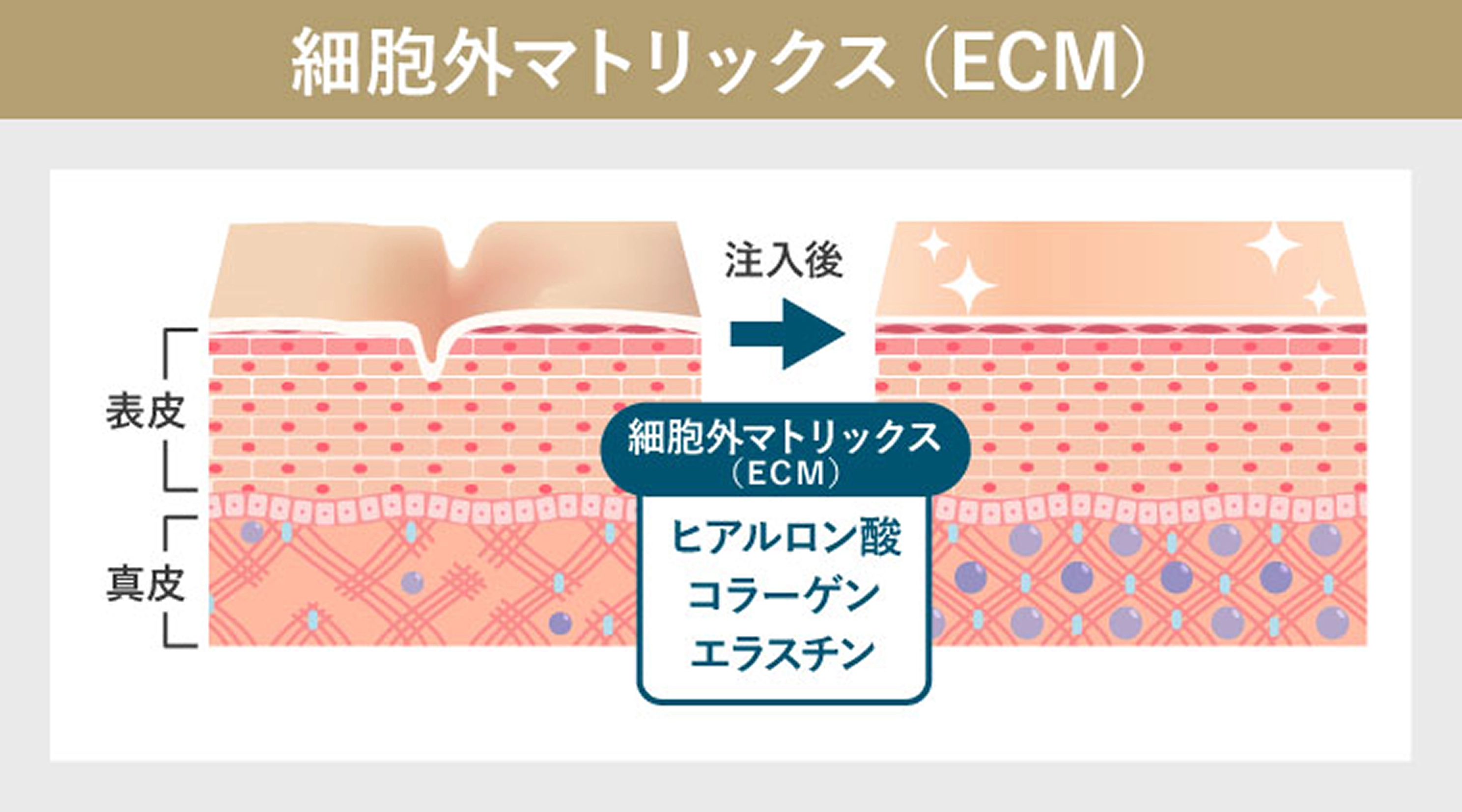 細胞外マトリックス(ECM)のイメージイラスト