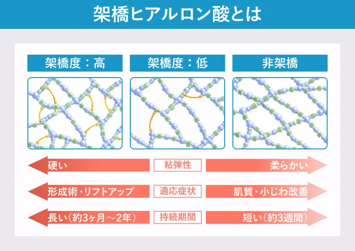 架橋ヒアルロン酸とは｜架橋度の違い（高・低・非架橋）と特徴を比較した図解