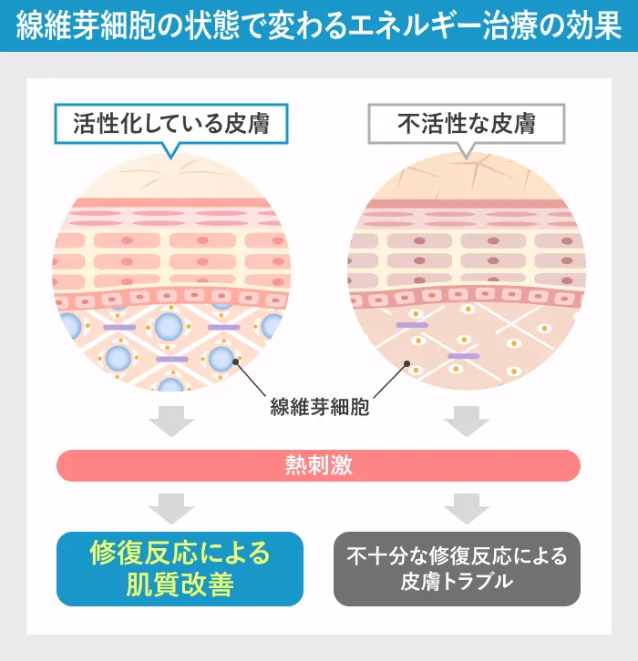 スキンバイブとエネルギー治療の関係｜線維芽細胞の状態で変わる効果を示した図解