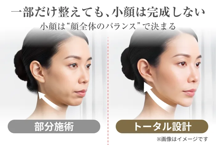 部分施術、トータル設計の比較画像